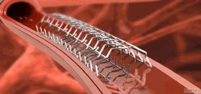 心血管支架噴砂機 心血管支架噴砂機